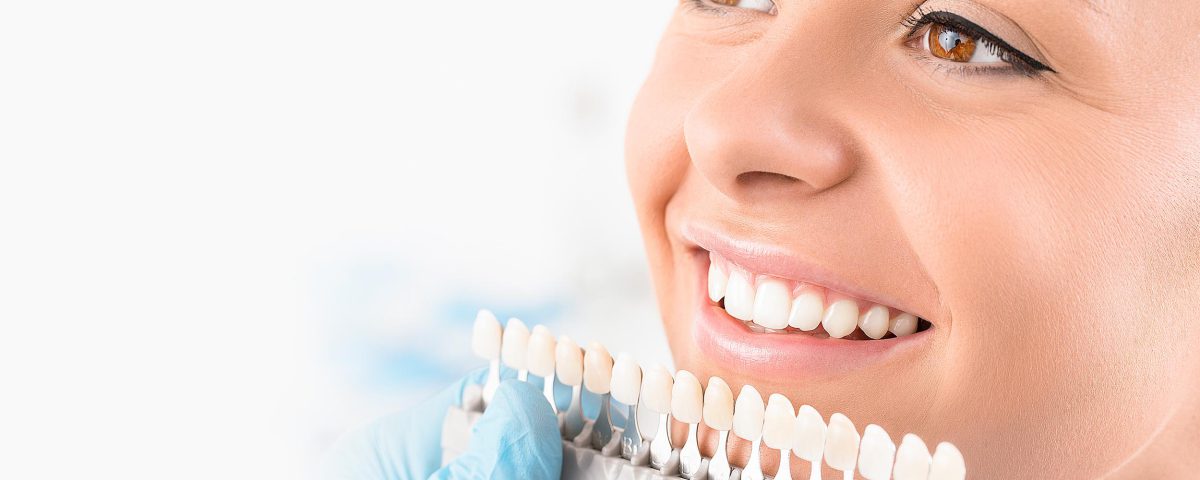 لمینت دندان دکتر فولادگر